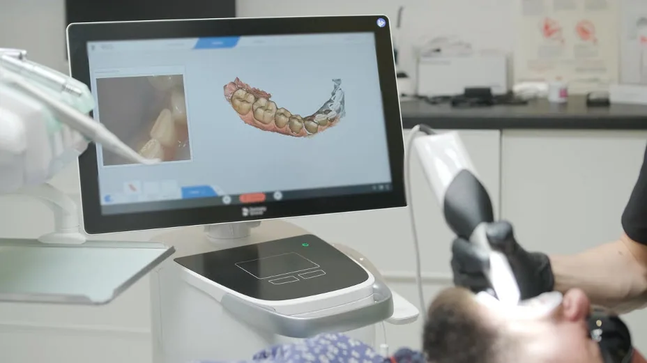 Digital Impressions at Blackstone Dental