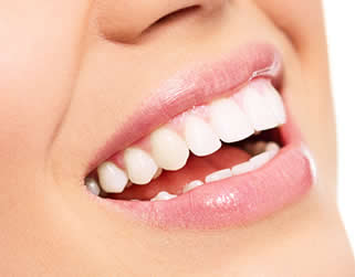 Is Teeth Whitening the Same as Teeth Bleaching – The Differences Explained