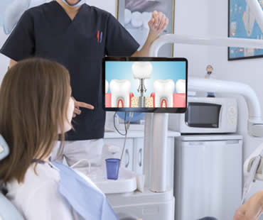 Frequently Asked Questions About Dental Implants